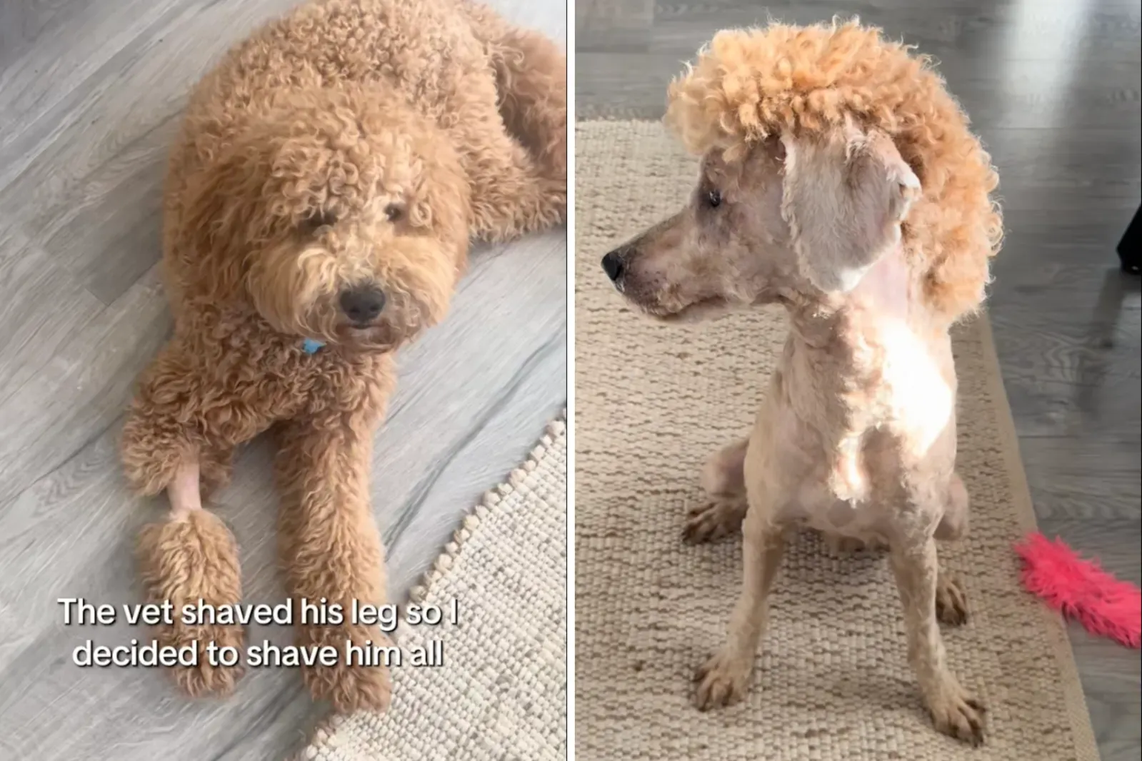 밴조 전후 사진