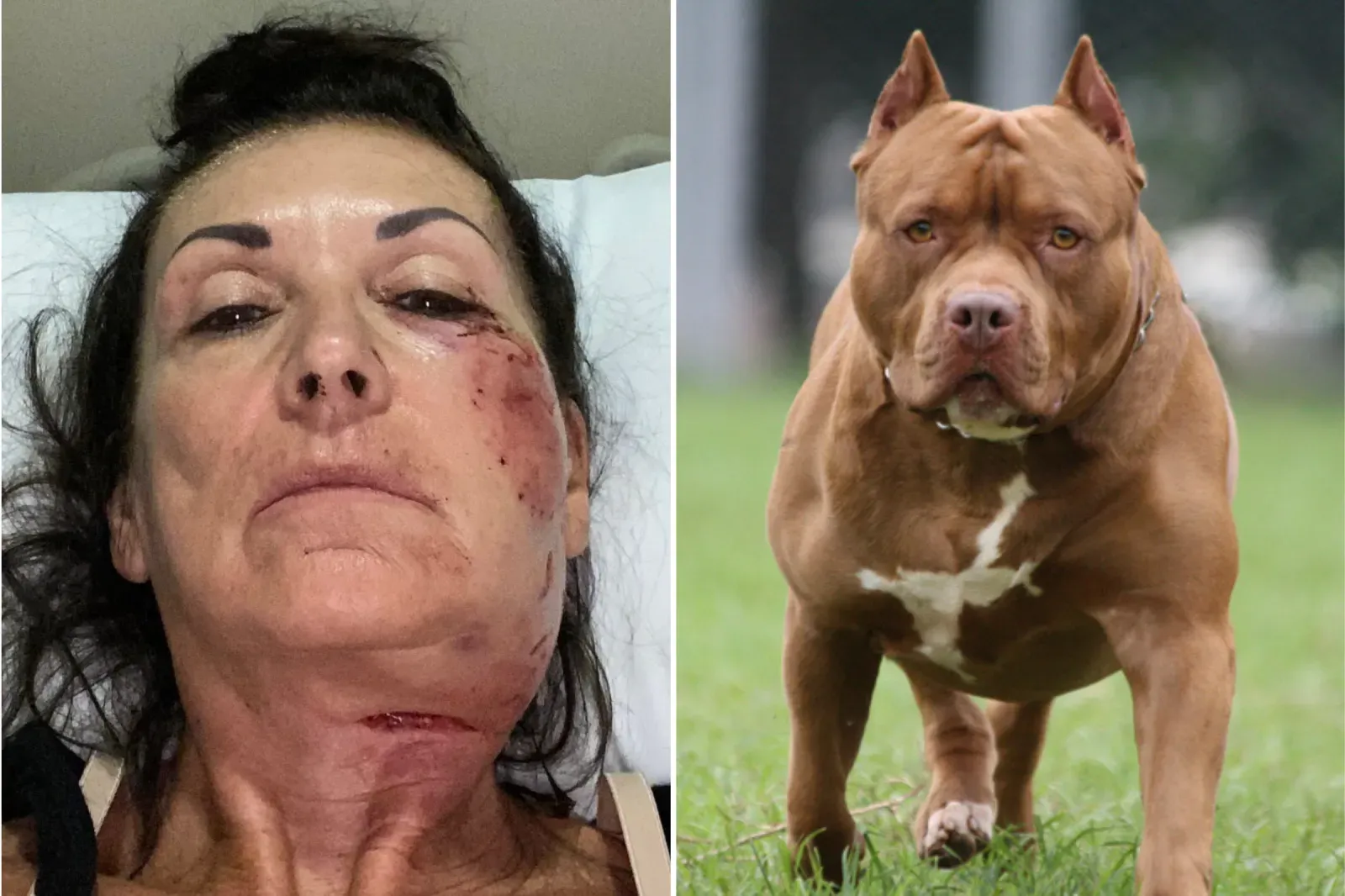 피트불, 목에 칼을 대고 덮쳐